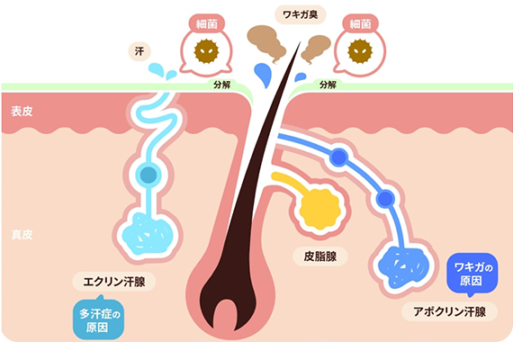 ワキガの仕組みを解説